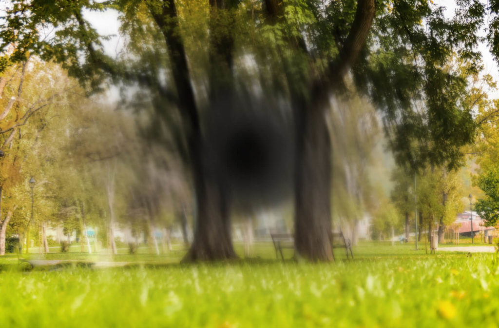 A sample vision of a person with AMD. Blurred or no vision in the center of the visual field.