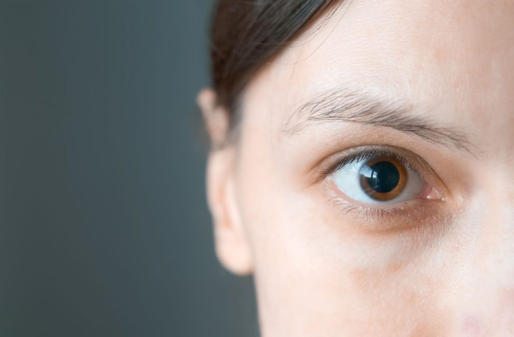 A closeup of a patient who has had their eyes dilated for an eye exam